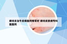 廊坊主治牛皮癣医院哪家好 廊坊皮肤病专科医医院