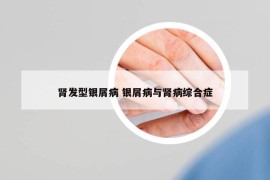 肾发型银屑病 银屑病与肾病综合症