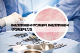 脓疱型银屑病可以吃板栗吗 脓疱型银屑病可以吃板栗吗女性