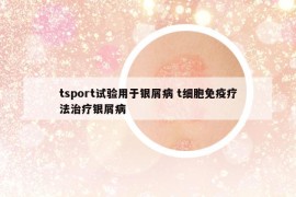 tsport试验用于银屑病 t细胞免疫疗法治疗银屑病