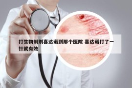 打生物制剂喜达诺到那个医院 喜达诺打了一针就有效