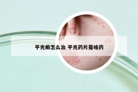 平光癣怎么治 平光药片是啥药