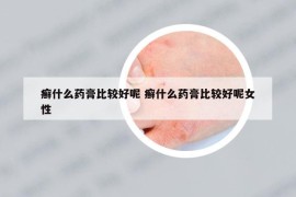 癣什么药膏比较好呢 癣什么药膏比较好呢女性