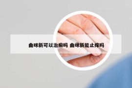 曲咪新可以治癣吗 曲咪新能止痒吗