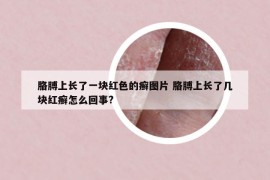 胳膊上长了一块红色的癣图片 胳膊上长了几块红癣怎么回事?