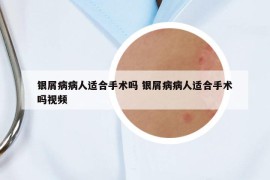 银屑病病人适合手术吗 银屑病病人适合手术吗视频