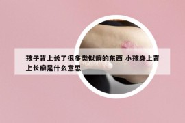 孩子背上长了很多类似癣的东西 小孩身上背上长癣是什么意思