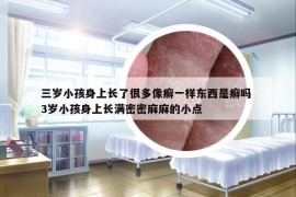 三岁小孩身上长了很多像癣一样东西是癣吗 3岁小孩身上长满密密麻麻的小点