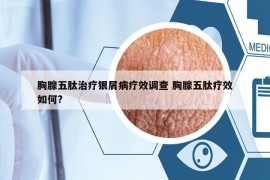 胸腺五肽治疗银屑病疗效调查 胸腺五肽疗效如何?