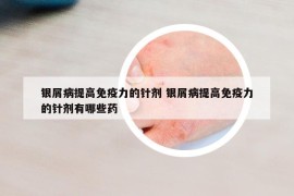 银屑病提高免疫力的针剂 银屑病提高免疫力的针剂有哪些药