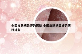 全国皮肤病最好的医院 全国皮肤病最好的医院排名