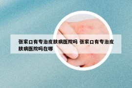 张家口有专治皮肤病医院吗 张家口有专治皮肤病医院吗在哪