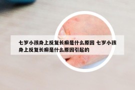 七岁小孩身上反复长癣是什么原因 七岁小孩身上反复长癣是什么原因引起的