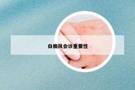 白癜风会诊重要性