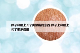 脖子和脸上长了类似癣的东西 脖子上和脸上长了很多疙瘩