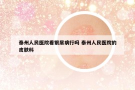 泰州人民医院看银屑病行吗 泰州人民医院的皮肤科