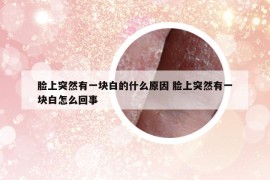 脸上突然有一块白的什么原因 脸上突然有一块白怎么回事