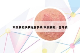 银屑颗粒换肤组合多钱 银屑颗粒一盒几袋