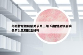 乌帕替尼银屑病关节炎三期 乌帕替尼银屑病关节炎三期能治好吗