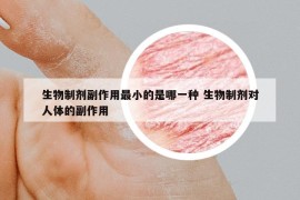 生物制剂副作用最小的是哪一种 生物制剂对人体的副作用