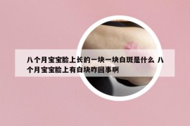 八个月宝宝脸上长的一块一块白斑是什么 八个月宝宝脸上有白块咋回事啊