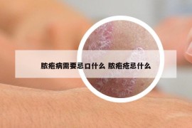 脓疱病需要忌口什么 脓疱疮忌什么