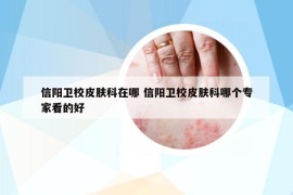 信阳卫校皮肤科在哪 信阳卫校皮肤科哪个专家看的好