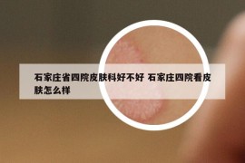 石家庄省四院皮肤科好不好 石家庄四院看皮肤怎么样