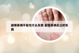 副银屑病不能吃什么东西 副银屑病忌口的东西