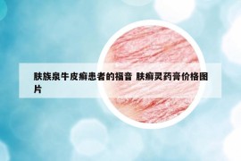 肤族泉牛皮癣患者的福音 肤癣灵药膏价格图片