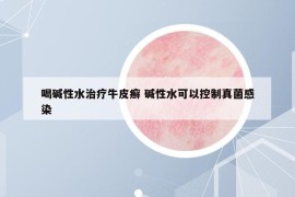 喝碱性水治疗牛皮癣 碱性水可以控制真菌感染