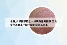 十五,六岁孩子脸上一块块白是咋回事 五六岁小孩脸上一块一块的白怎么回事