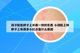 孩子脸色脖子上长癣一样的东西 小孩脸上和脖子上有很多小红点是什么原因