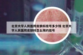 北京大学人民医院皮肤科挂号多少钱 北京大学人民医院皮肤科怎么预约挂号