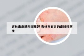 吉林市皮肤科哪里好 吉林市有名的皮肤科医生