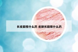 长皮藓擦什么药 皮肤长藓擦什么药