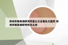 郑州市银屑病研究院是公立还是私立医院 郑州市银屑病研究院怎么样