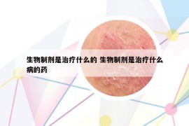 生物制剂是治疗什么的 生物制剂是治疗什么病的药