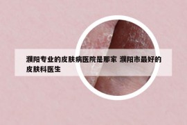 濮阳专业的皮肤病医院是那家 濮阳市最好的皮肤科医生