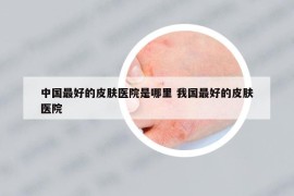 中国最好的皮肤医院是哪里 我国最好的皮肤医院