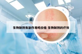 生物制剂有副作用吗价格 生物制剂的疗效