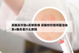 尿酸高抗链o高银屑病 尿酸和抗链球菌溶血素o偏高是什么原因