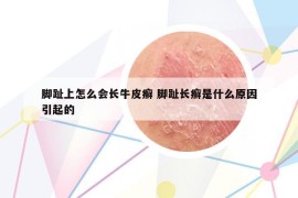 脚趾上怎么会长牛皮癣 脚趾长癣是什么原因引起的