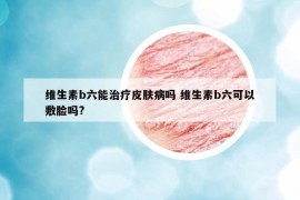 维生素b六能治疗皮肤病吗 维生素b六可以敷脸吗?