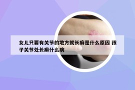 女儿只要有关节的地方就长癣是什么原因 孩子关节处长癣什么病