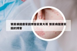 银屑病健康家园博客寂寞大哥 银屑病健康家园的博客