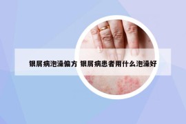 银屑病泡澡偏方 银屑病患者用什么泡澡好