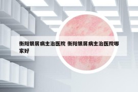 衡阳银屑病主治医院 衡阳银屑病主治医院哪家好