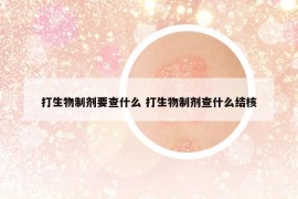 打生物制剂要查什么 打生物制剂查什么结核