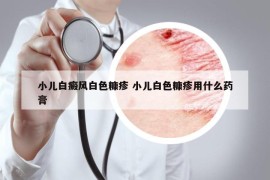 小儿白癜风白色糠疹 小儿白色糠疹用什么药膏